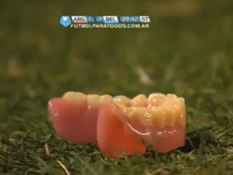 Televisão flagrou dentadura jogada no gramado / Reprodução