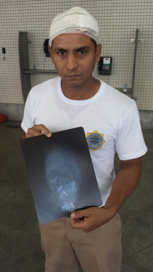 Guarda agredido mostra radiografia / Divulgação Guarda Municipal RJ