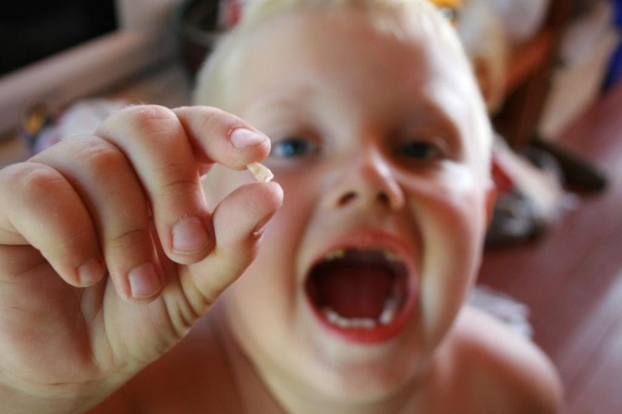 Mesmo antes da chegada dos primeiros dentes, os pais já devem procurar um dentista