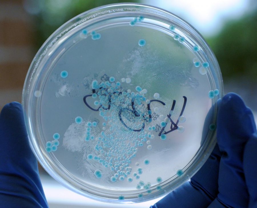 Bactéria E.coli já provocou 22 mortes na Europa