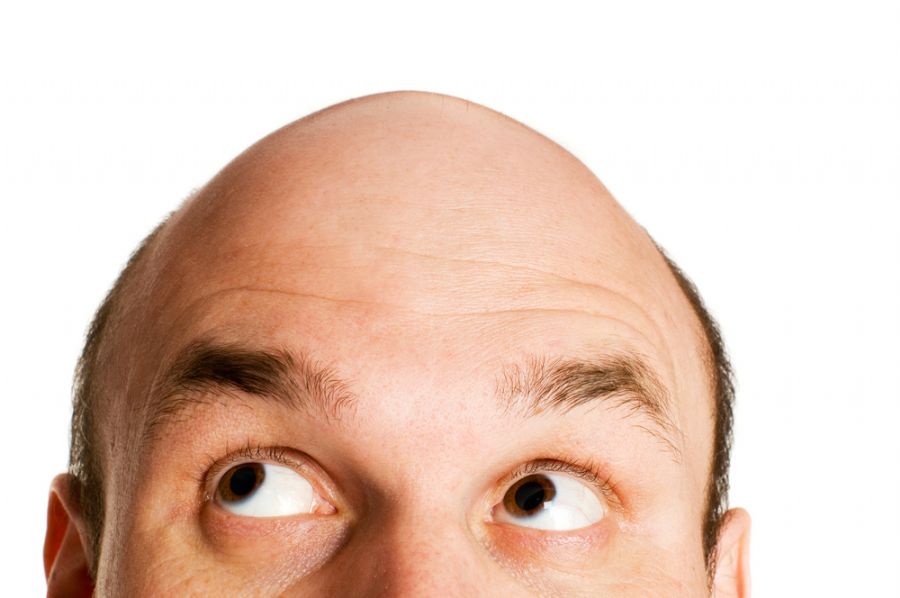 Estresse pode levar à queda de cabelos / Maga/ Shutterstock