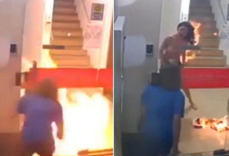 Neurologista comenta caso de mulher que teve corpo incendiado após briga com namorada