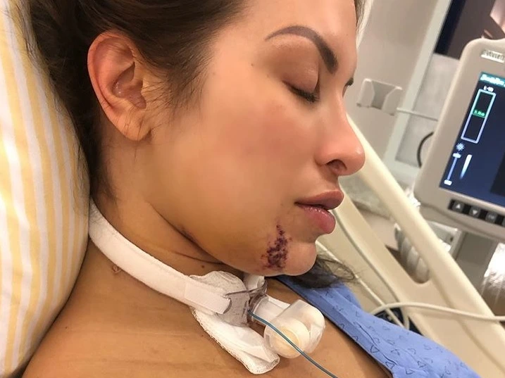 Dieynne Saugo usou sua conta no Instagram para tirar dúvidas sobre o acidente